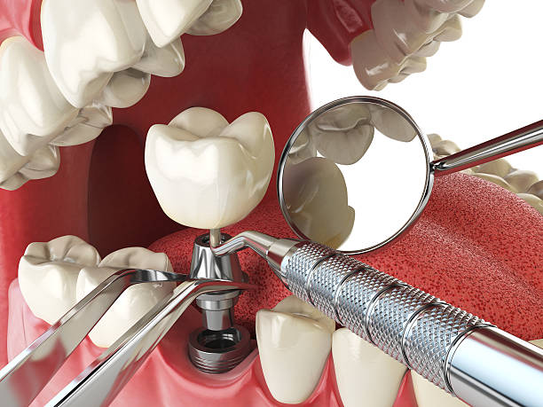 Best Emergency Gum Treatment in Lipscom, AL